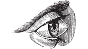 keratocone operation keratocone paris keratocone diagnostic maladies des yeux docteur nathalie butel ophtalmologiste paris 16 ophtalmologue paris 16