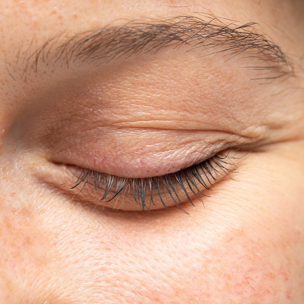 chirurgie des paupieres blepharoplastie paris dr nathalie butel chirurgien ophtalmologue specialiste chirurgie refractive cataracte oculoplastique paris