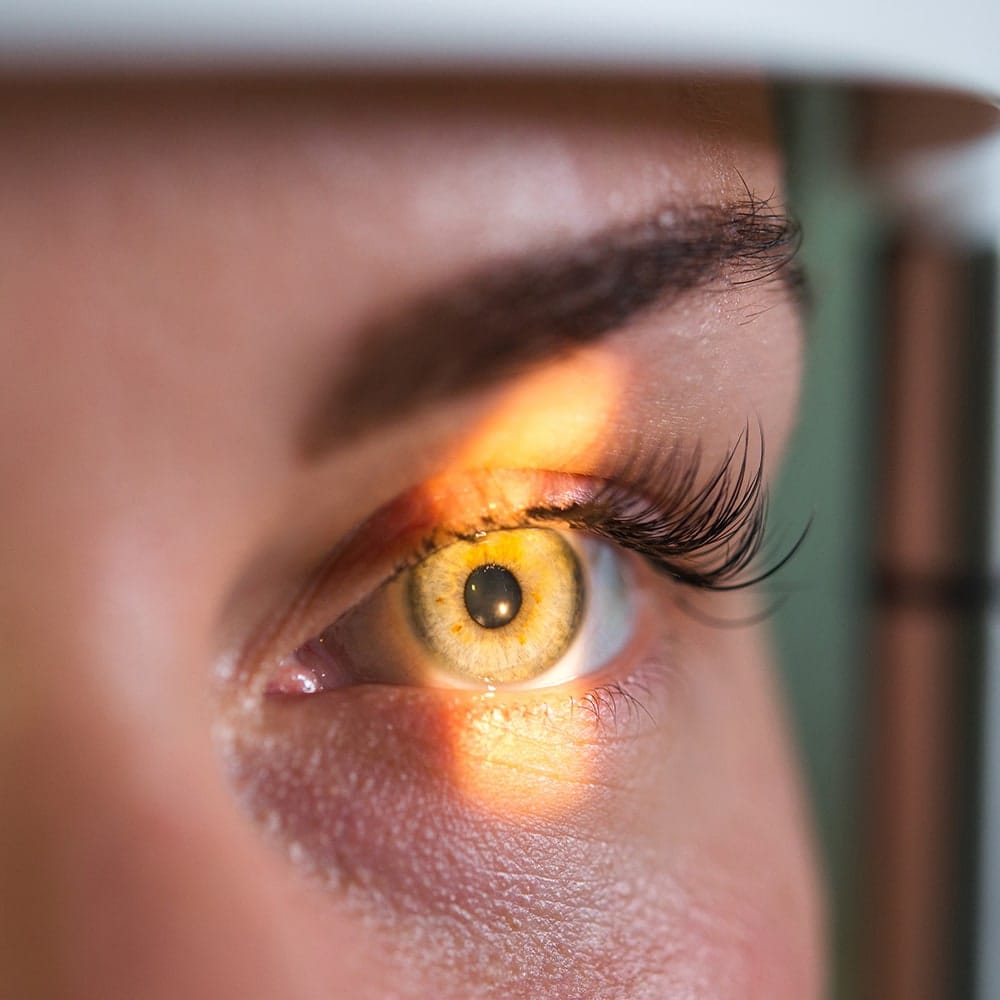 decollement de retine symptomes traitement dr nathalie butel chirurgien ophtalmologue specialiste chirurgie refractive cataracte oculoplastique paris