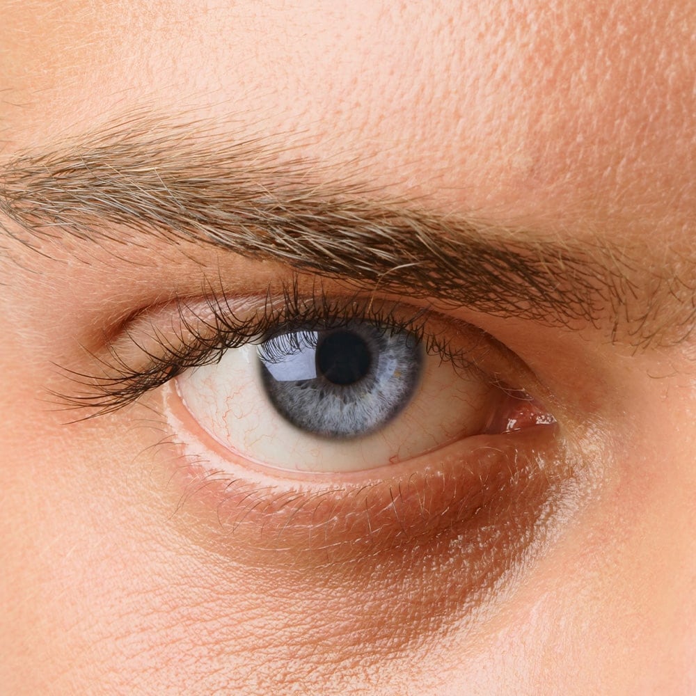 decollement vitre dr nathalie butel chirurgien ophtalmologue specialiste chirurgie refractive cataracte oculoplasticien paris