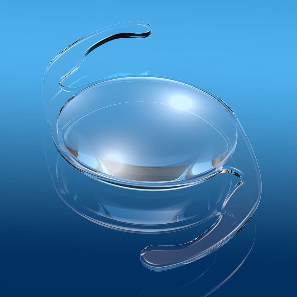 implant edof dr nathalie butel chirurgien ophtalmologue specialiste chirurgie refractive cataracte oculoplasticien paris