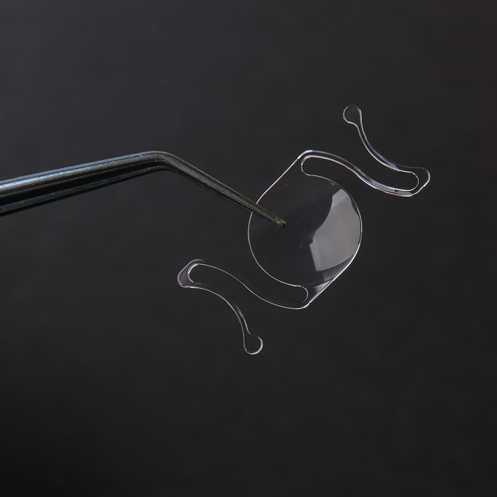 implant torique cataracte dr nathalie butel chirurgien ophtalmologue specialiste chirurgie refractive cataracte oculoplasticien paris
