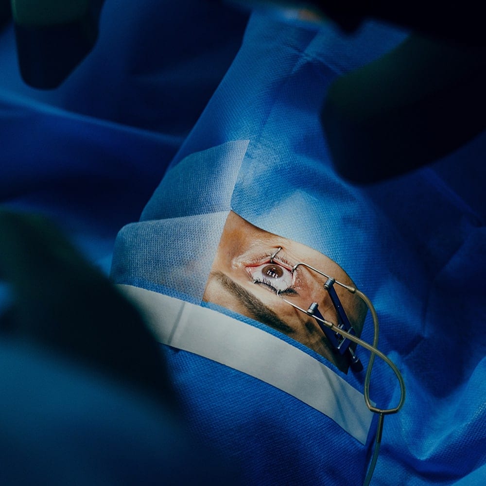 laser operation pkr dr nathalie butel chirurgien ophtalmologue specialiste chirurgie refractive cataracte oculoplasticien paris