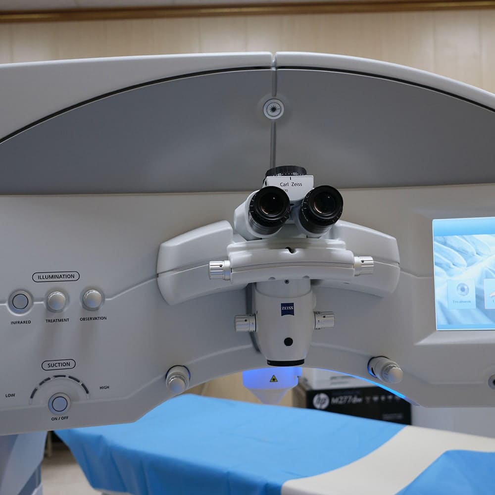 laser operation smile yeux dr nathalie butel chirurgien ophtalmologue specialiste chirurgie refractive cataracte oculoplasticien paris